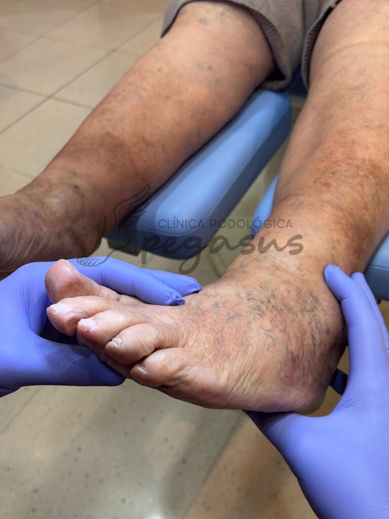 Atención podológica geriátrica.