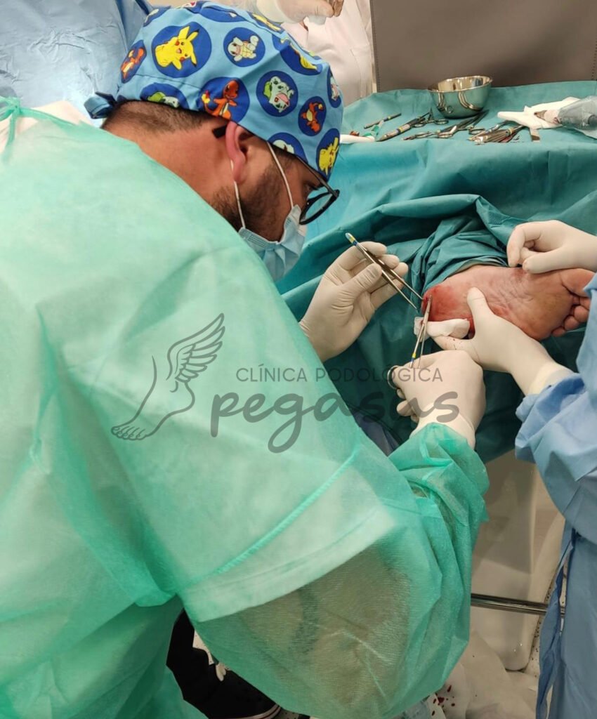Cirugía podológica en clínica Pegasus.