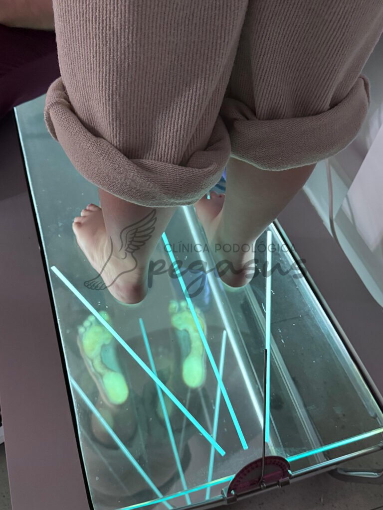 Estudio de la pisada en clínica podológica Pegasus.